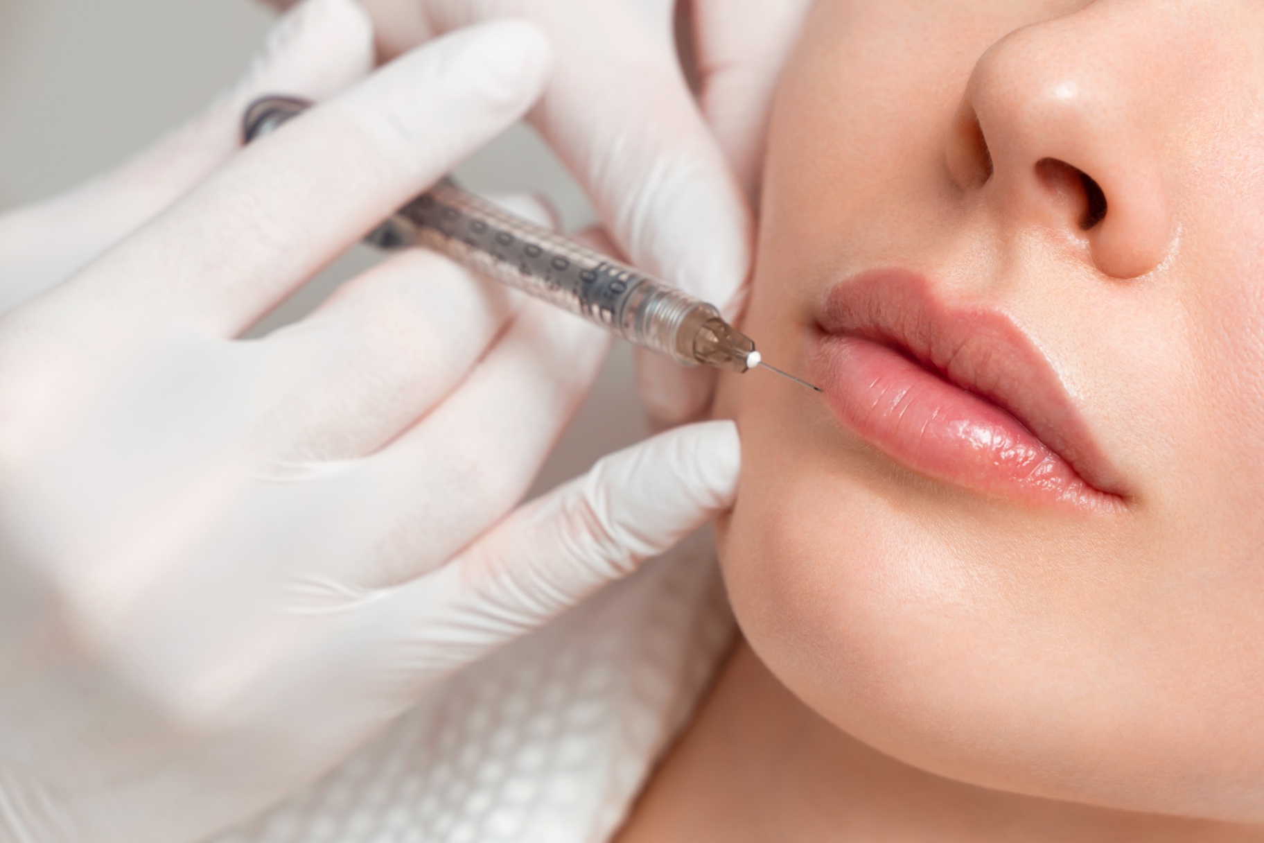 Fillers behandling